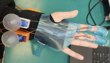EEG-Controlled Hand Exoskeleton