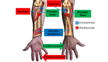 EEG-Controlled Hand Exoskeleton